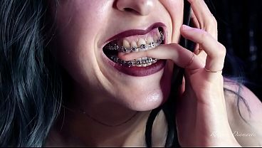 Biting my own fingers – bite, mouth, teeth, braces, fetish ITA