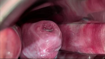 Masked Whore Extreme Cervix View and Double Vaginal Fisting